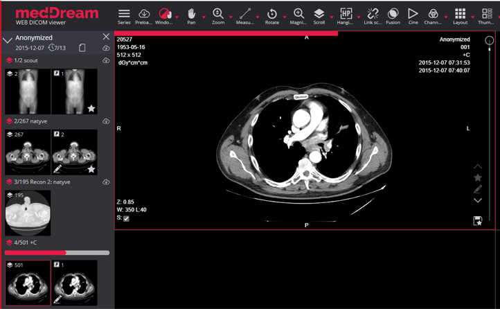 free dicom viewer with mpr